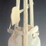 la scoliosi idiopatica