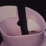 la scoliosi idiopatica