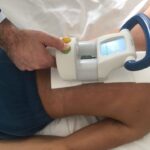 la scoliosi idiopatica